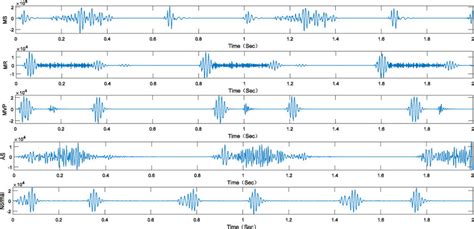 Examples of cardiac sounds in the public database provided by [28]. The... | Download Scientific ...