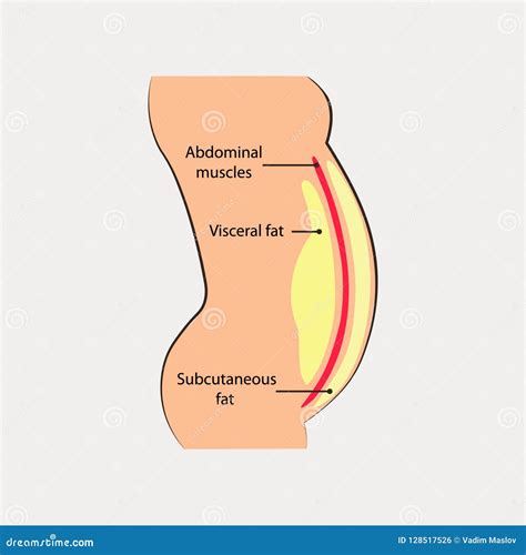 Human Abdominal Muscles Ocation Of Visceral Fat Stored Within