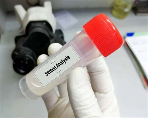 Semen Analysis Mrldc Diagnostic Centre