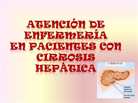 PPT 43266476 Cirrosis Hepatica Cuidados Enfermeria222 DOKUMEN TIPS