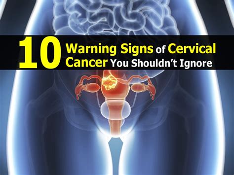 Cervical Cancer Symptoms Warning Signs