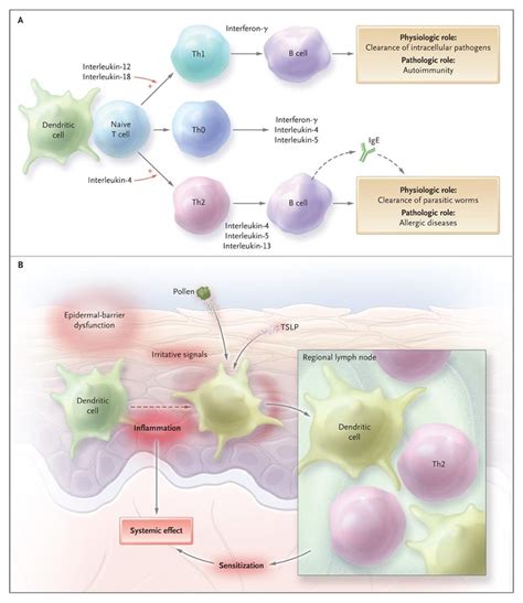 Atopic Dermatitis Nejm