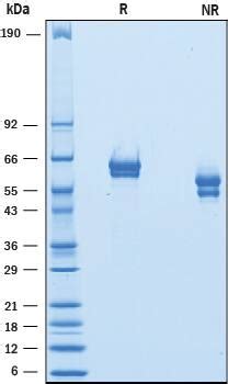 Recombinant Mouse GFR Alpha 1 His Tag Protein CF 10070 GR Novus