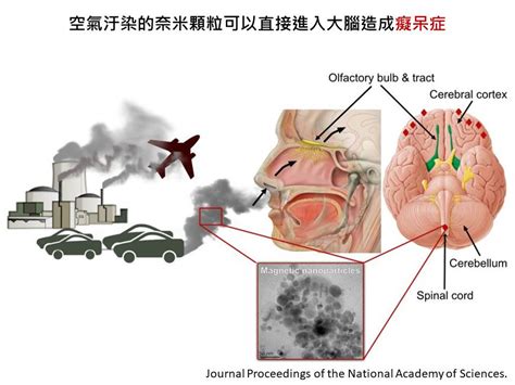 胸腔重症蘇一峰醫師 比pm2 5更恐怖的空氣污染物質 奈米懸浮微粒汙染