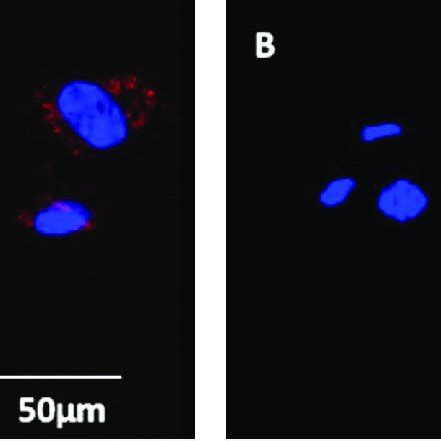 A Untreated Lps Pepg Huvec Pn Cell Line Binds Nm N Ofq Atto