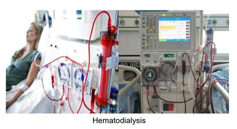 Hemodializador Desechable De Bajo Flujo Para Purificaci N De Sangre