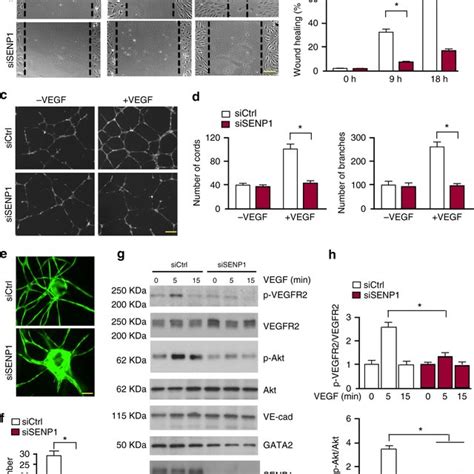 Cell Cycle And Dna Damage Dependent Sumoylation Of Pcna A Hispol