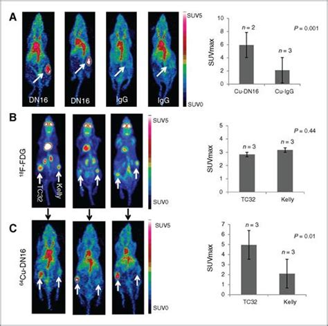 Targeted Imaging Of Ewing Sarcoma In Preclinical Models Using A 64cu