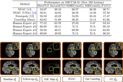 Figure 1 From Coactseg Learning From Heterogeneous Data For New Multiple Sclerosis Lesion