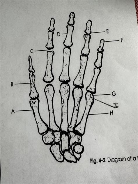 Hand Diagram Quizlet