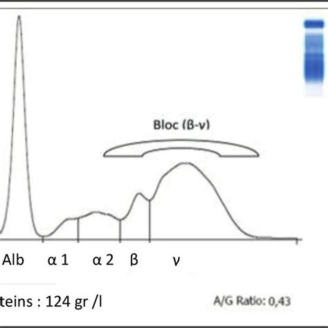 Plot Of Blood Serum Electrophoresis Of Cow With Liver Download