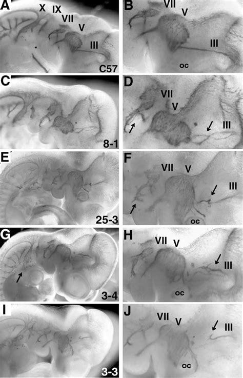 Cranial Nerve Development Semantic Scholar