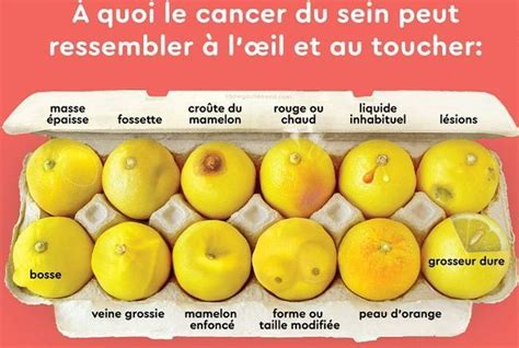 Octobre Rose Voici Comment Des Citrons Peuvent Vous Aider Auto