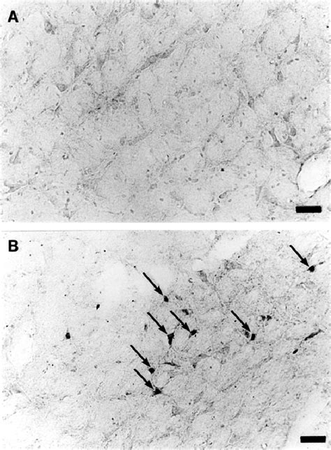 Photomicrographs Showing Fos Immunopositive Neurons In Rvlm Cvlm Region