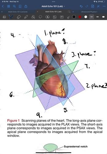 Scanning Planes Of The Heart Flashcards Quizlet