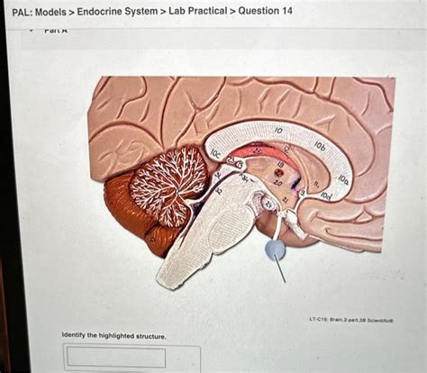 Solved PAL Models Endocrine System Lab Practical Chegg