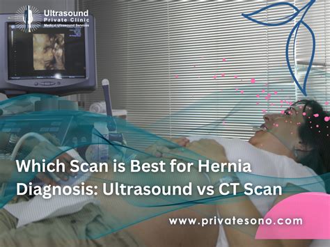 Which Scan Is Best For Hernia Diagnosis Ultrasound Vs Ct Scan