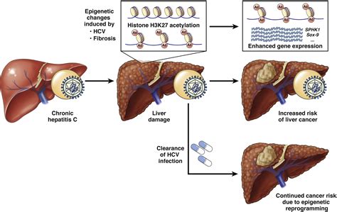 Indelibly Stamped By Hepatitis C Virus Infection Persistent Epigenetic