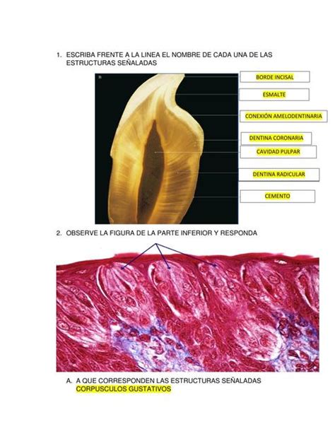 Histologia De Papilas Gustativas The Best Porn Website