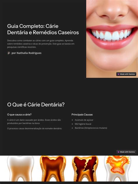 Meu Dente Dói Mas Não Tem Cárie O Que Fazer - Combate à Cárie: Guia e Remédios Caseiros | PDF | Esmalte dentário ...