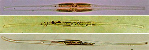 Light Microscopy In Vivo Cells Of Cylindrotheca Closterium From The