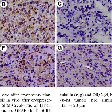 Expression Of Stem Cell Markers And Proliferation Marker Ki In Btscs