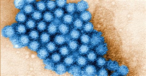 Norovirus Contagio Sintomi E Strategie Di Prevenzione