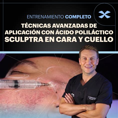 Técnicas avanzadas de aplicación de ácido poliláctico sculptra en cara