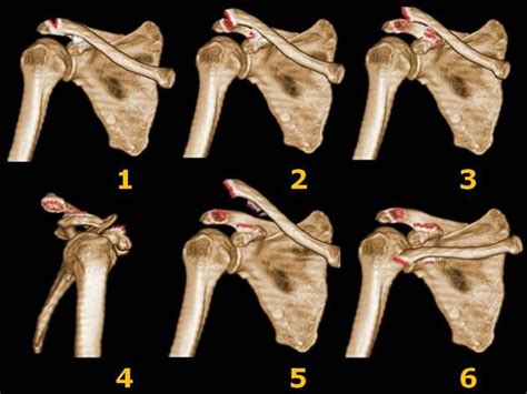 Pin on Radical Radiology