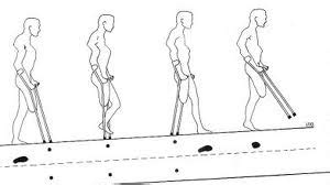 Blog De Fisioterapia La Fat Dica Pregunta Y C Mo Uso Las Muletas