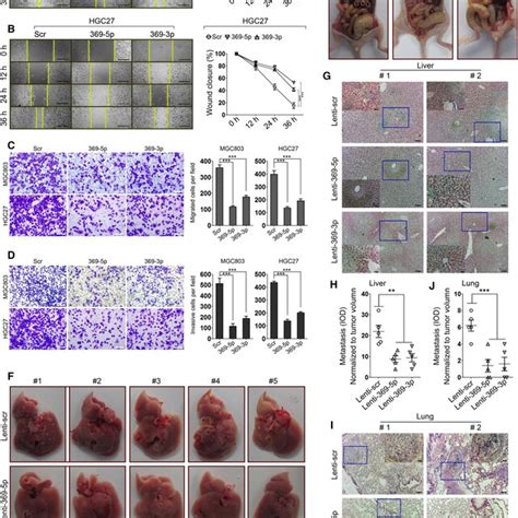 Overexpression Of Mir P P Suppresses Gc Cell Invasion A B The