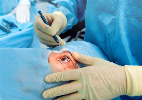 Cataract Surgery Applecross Eye Clinic