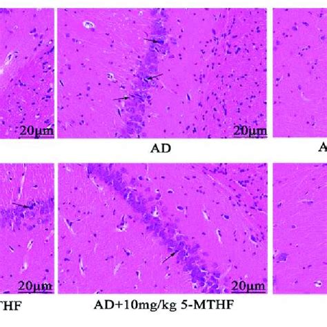 Typical HE Staining Images Of The Hippocampal CA1 Region Magnification