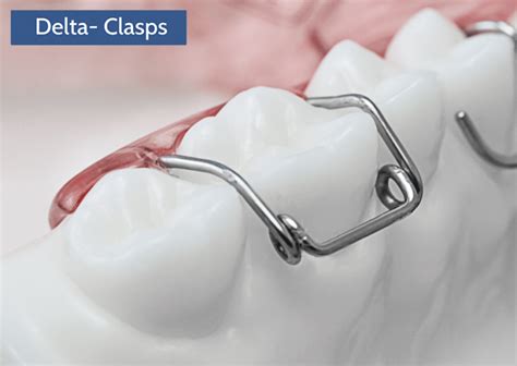 Clasps Universal Orthodontic Lab