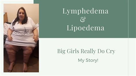 My Story My Legs Lymphedema Lipoedema Youtube