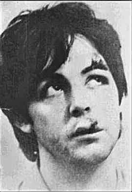 Car Accident: Paul Mccartney Car Accident 1966 Photos