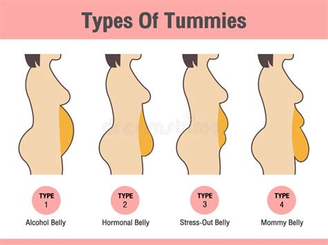 Types Of Tummies For Women. Overweight Woman Illustration de Vecteur ...