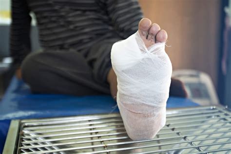 How Diabetic Foot Ulcers Lead to Amputations - Podimetrics