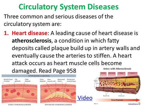 Diseases of circulatory system list