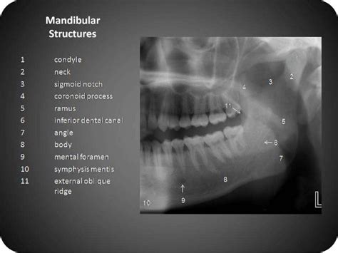 Panoramic radiography