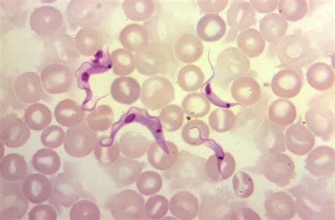 Trypanosoma Cruzichagas Disease Concise Medical Knowledge