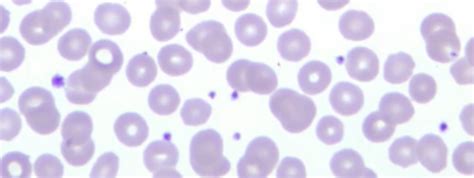 Normal Hemostasis And Lab Testing Flashcards Quizlet