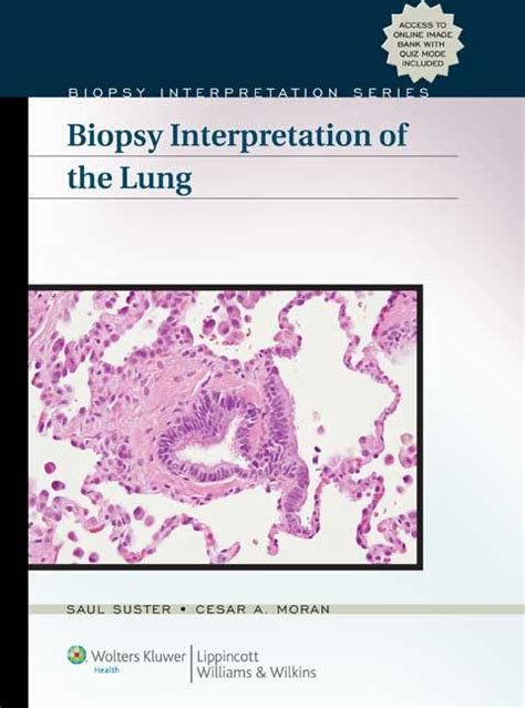 Biopsy Interpretation of the Lung (Biopsy Interpretation Series ...