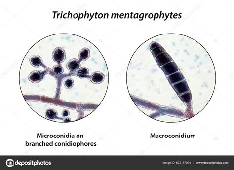 Hongos Trichophyton Mentagrophytes Ilustración Que Muestra Conidióforos Ramificados Con