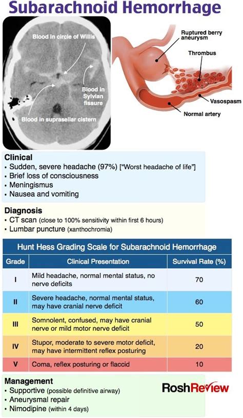 Headache red flags mnemonic images | aboutheadache