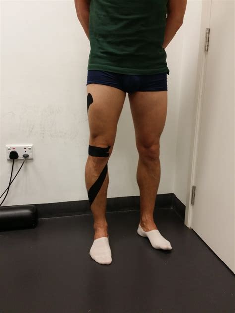 How To Apply Kt Tape To Knee For Acl