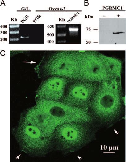 Expression Of Pgr And Pgrmc In Ovcar Cells The Presence Of Mrna