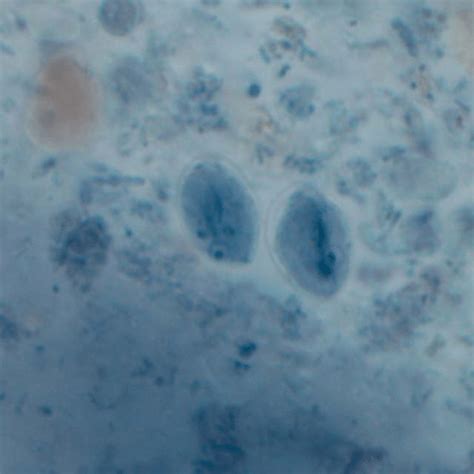 Giardia Duodenalis Cysts Giemsa Stain Â 1000 Figure 3 Naegleria Download Scientific Diagram