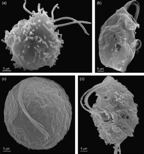 Sem Of Trichomonas Vaginalis Trophozoites Treated With Aza Cells Download Scientific Diagram