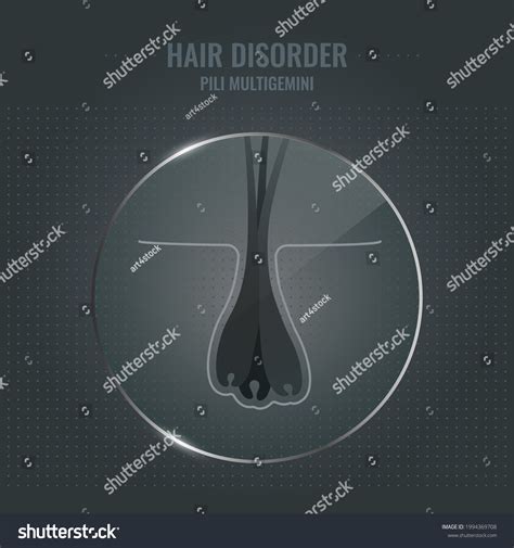 Pili Multigemini Hair Disorder Surface Under Royalty Free Stock